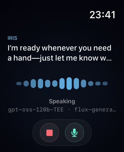 Iris responding - speaker label switches, transcript updates